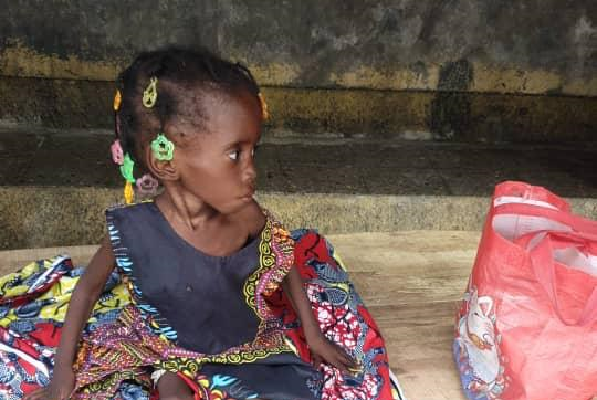 Malnutrition enfants